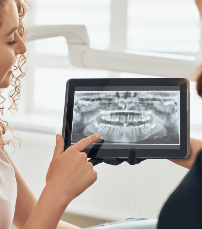 selective-focus-x-ray-picture-teeth-tablet-1